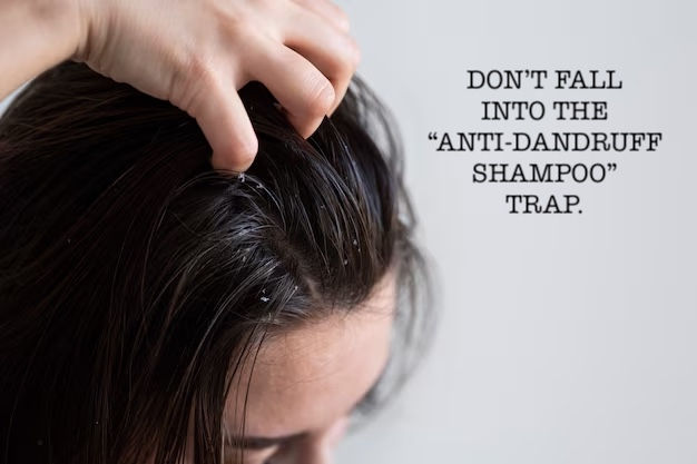 the anti-dandruff shampoo myth