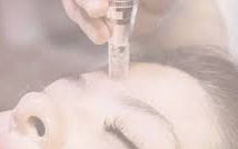 eine Frau die Microneedling macht