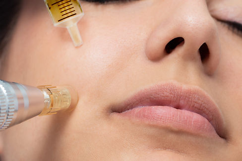 dermapen-vitaminas-scaled.jpeg