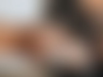 Dandruff | 8 Drugstore Products & How they work