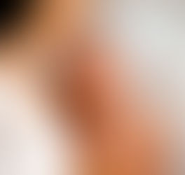 Meu filho nasceu com 6 dedos no pé: o que fazer?