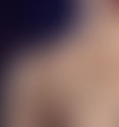 Tumoração no ombro de crianças