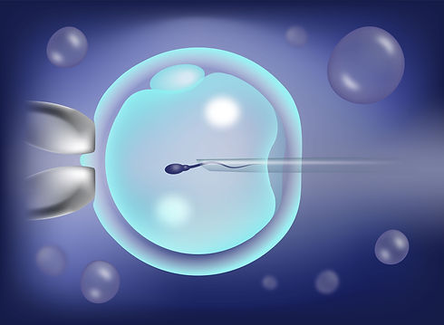 60f12fe2a698c51c8a3c113b_Intracytoplasmic Sperm Injection Cloudnine.jpg