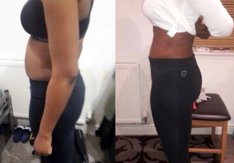 before and after