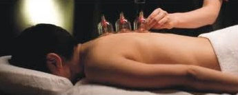 cupping2.jpeg
