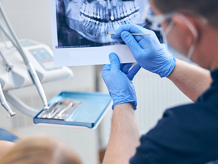 PERI - IMPLANTITIS