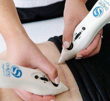 scar release therapy photo.jpg