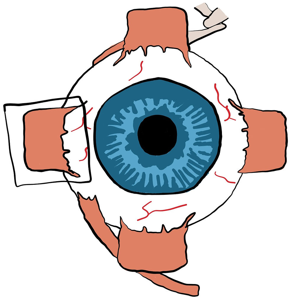 Eye muscle affected in 6th nerve palsy