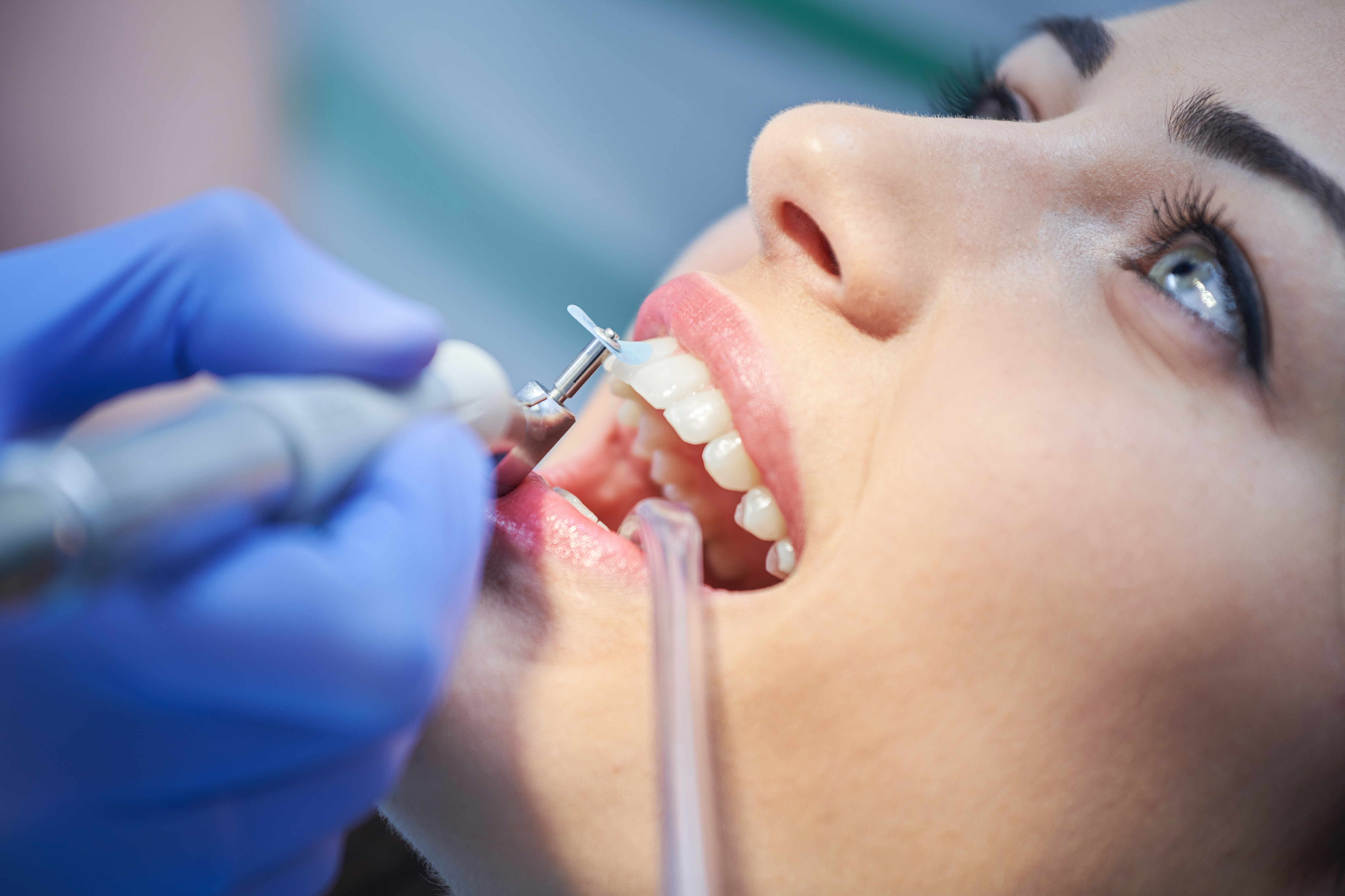 Prophylaxe in Buchs AG