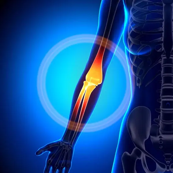 depositphotos_58734761-stock-photo-female-elbow-anatomy-bones.jpg