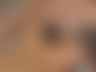 Terapia TECAR – recuperare modernă pentru dureri de spate, articulații și mușchi