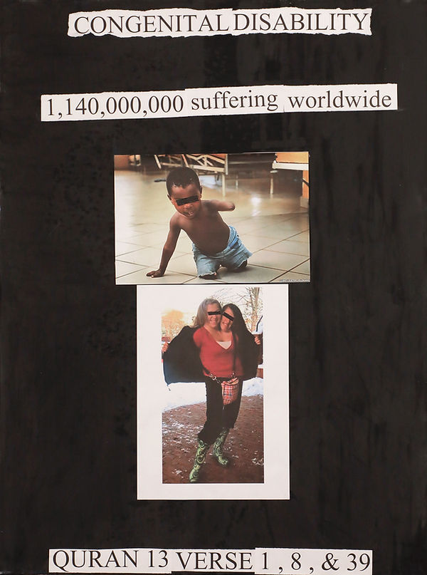Congenital-disability.jpg