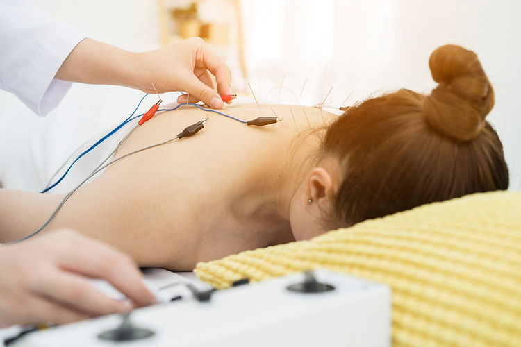 doctor or Acupuncturist applying electro