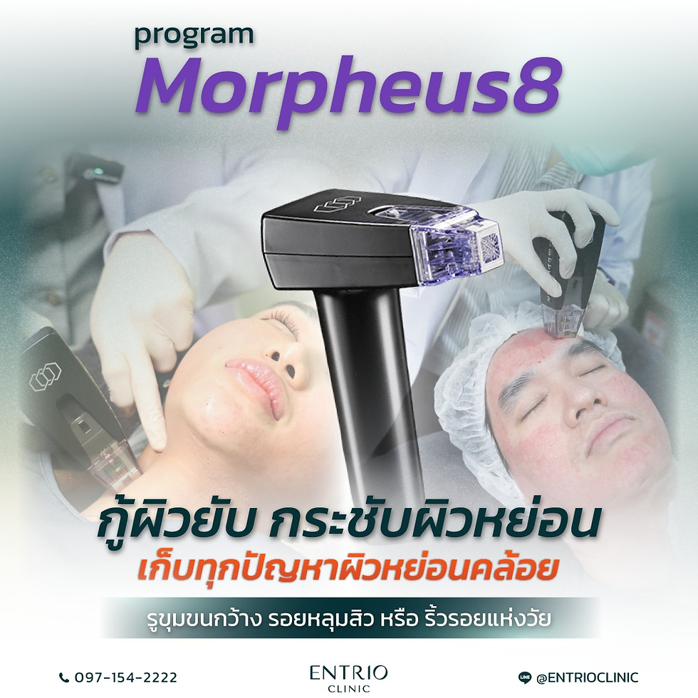 Morpheus8: 'Helper' for Minor Fat Reduction, Skin Tightening, Improving Skin Texture (The Skin Refiner & Volume Reducer)
