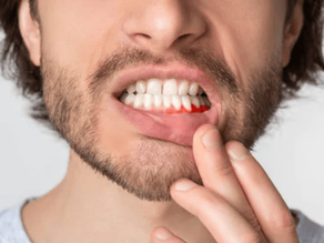 Could Your Gums Be Trying to Tell You Something?