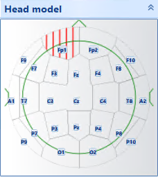 eeg report head model