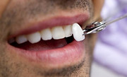Porcelain Veneers at Cape Cod Restorative Dentistry