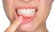 Periodontal Treatment at Cape Cod Restorative Dentistry