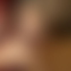 歯が抜けてきたよ。