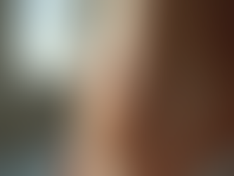 Causes Behind Stretch Marks and Solutions