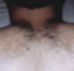 Hairy Back Before