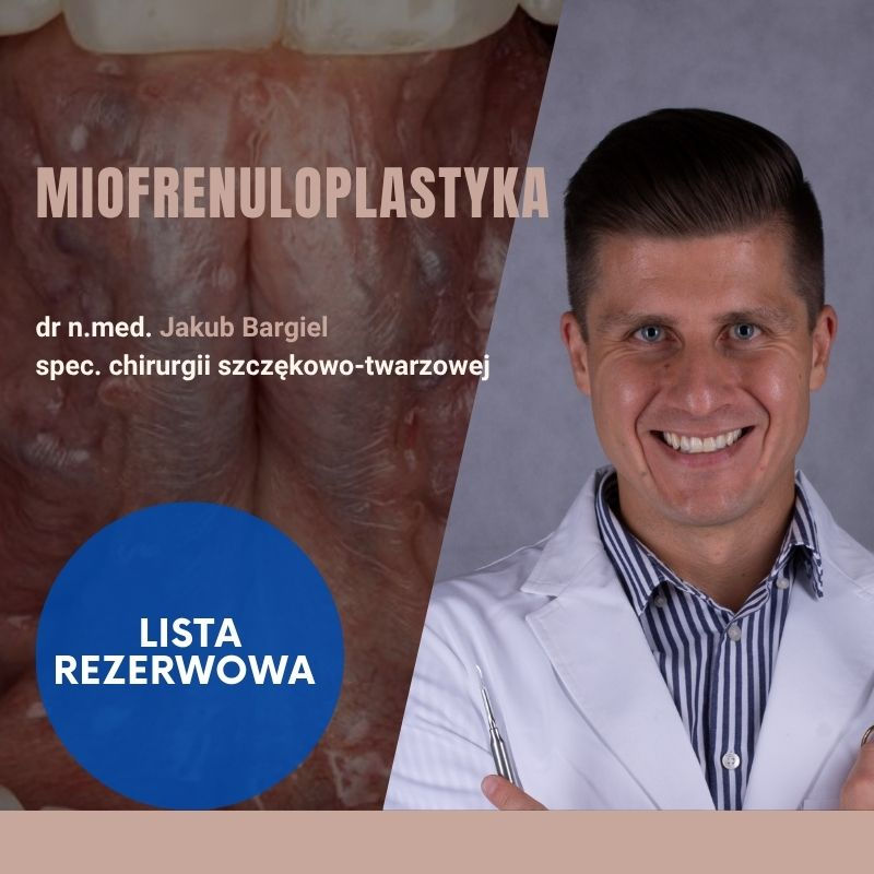 Miofrenuloplastyka - lista rezerwowa