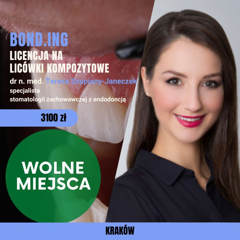 BOND.ING - licencja na licówki kompozytowe