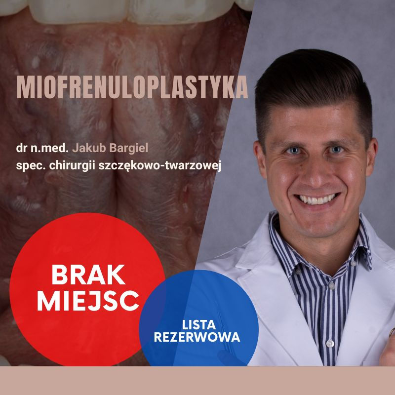 Miofrenuloplastyka