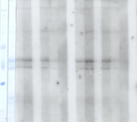 NC1と検体の反応結果