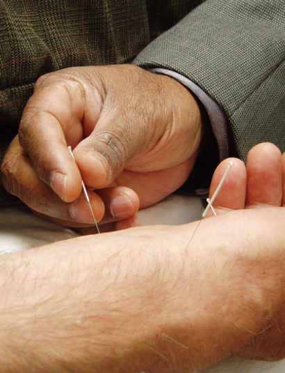 acupuntura.jpg