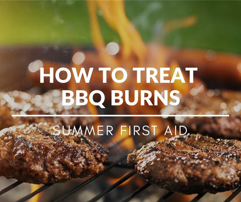 How To Treat Barbecue Burns Summer First Aid