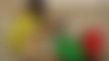 Mujer Nacida Sin Cuerpo En Nigeria - Girl Born Without Body In Nigeria