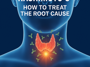 Hashimotos Thyroiditis