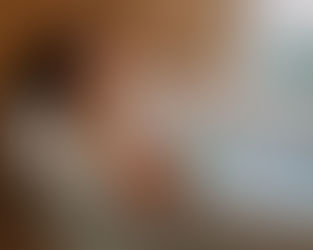 Skin Bytes | "How Late Nights Affect Your Skin — And How to Save It This Festive Season"