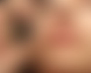 Skin Bytes | "💋 The Skin on Your Lips Deserves Love Too — Here's Why"