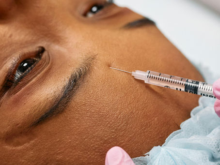 Skin Bytes | "Botox: Should You Start Sooner or Later?"