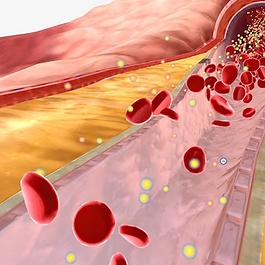 糖尿病引起的动脉硬化
