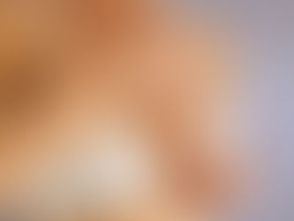 Nâng ngực nội soi bao lâu thì lành - Bác Sĩ thẩm mỹ chia sẽ