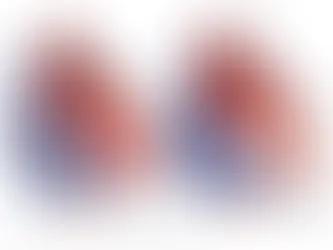 Hypertrofisk kardiomyopati (HCM)