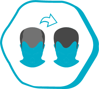 The Best Hair Transplant Clinic in Turkey istavita Hair Transplant Clinic