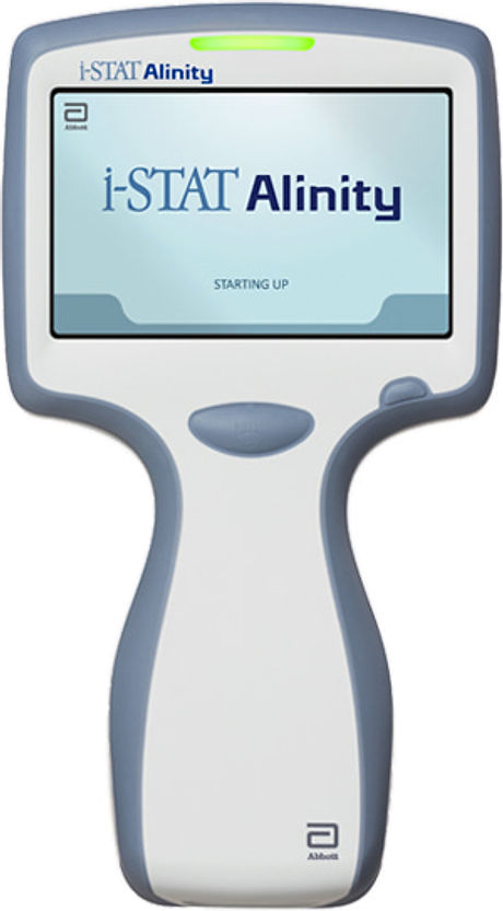 istat-alinity-system-features.jpg