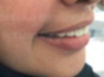 e4.png