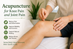 Acupuncture for Knee Pain and Joint Pain: Real Patient Experiences in Madison