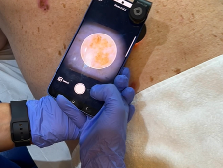 Come and experience a stress free Mole Mapping appointment with George