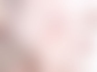 ニキビ跡は消せる！セルフケア５つのポイント