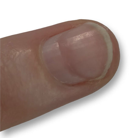 Ring of fire - mikä se on ja miten sen voi estää?