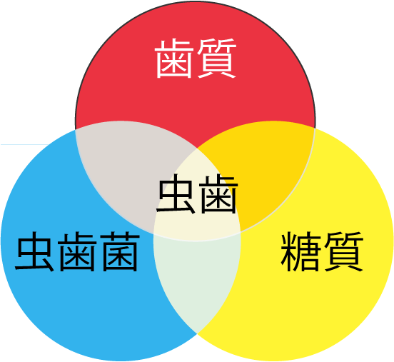 カイスの輪(糖質・歯質。虫歯菌でむし歯になる)