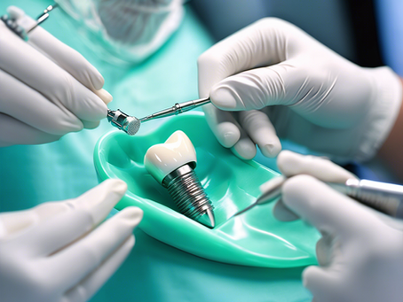 Transform Your Smile with Dashmesh Dental Implants