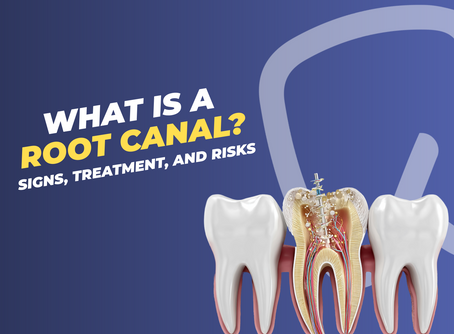 Blog cover reading “What is a root canal? Signs, treatment, and risks,” featuring a detailed tooth cross-section showing the root canal procedure and internal anatomy.