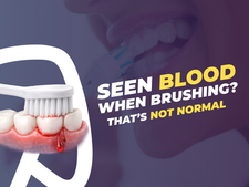 Blog cover reading “Seen blood when brushing? That’s not normal,” with a toothbrush brushing gums that are bleeding, illustrating a common sign of gum disease.